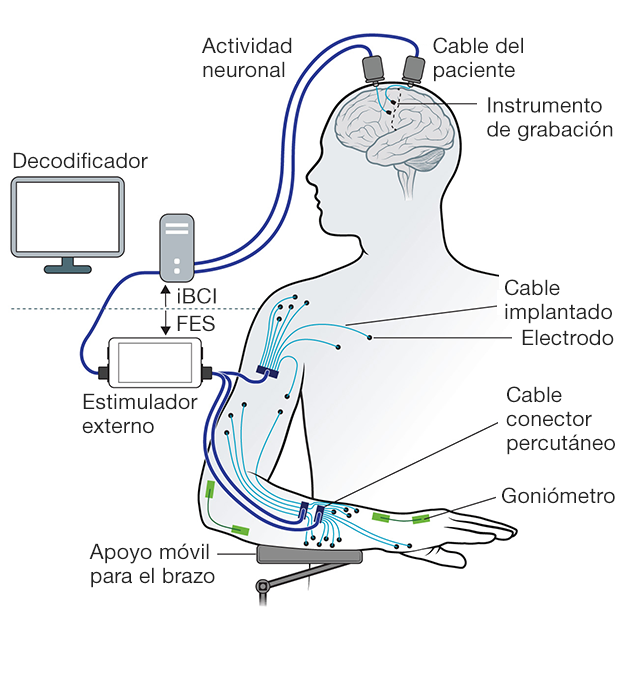 Ilustración de la tecnología empleada Ilustración de la tecnología empleada