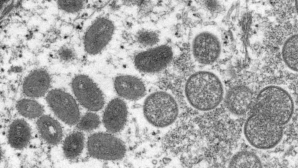 O monkeypox visto em microscópio eletrônico