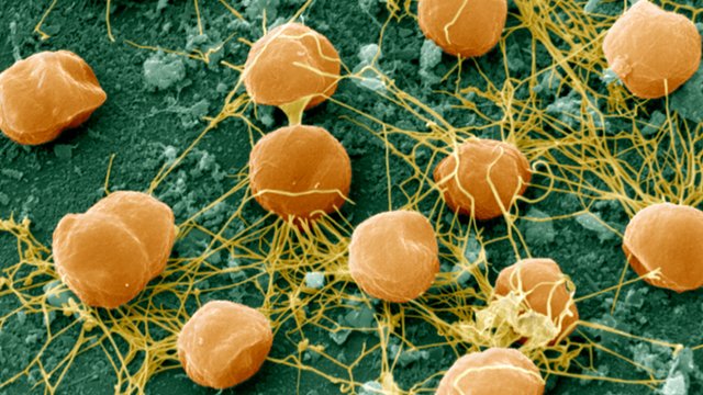 SEM image of Archaea