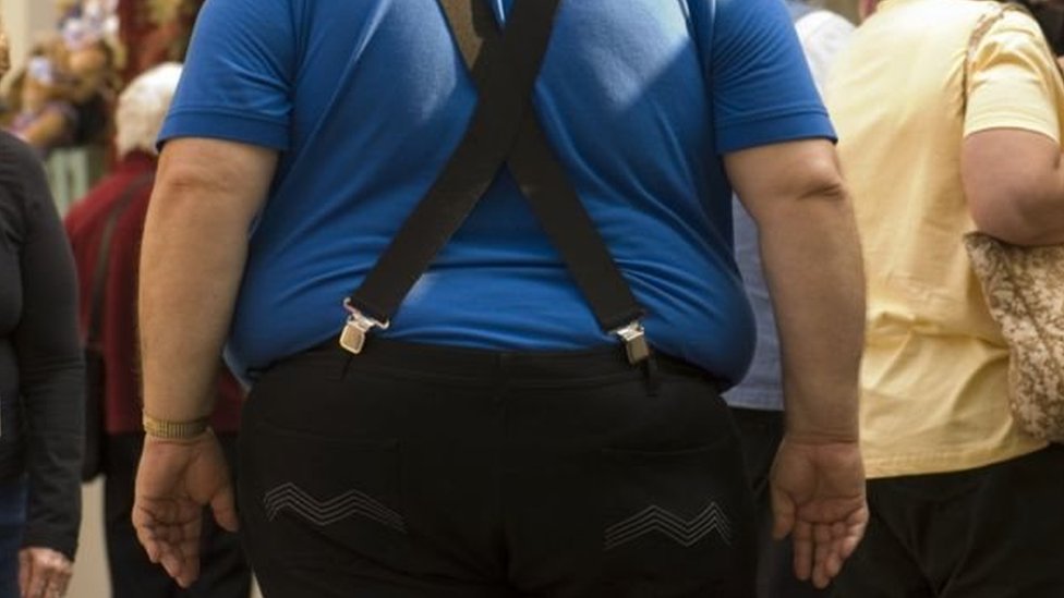 obesitas