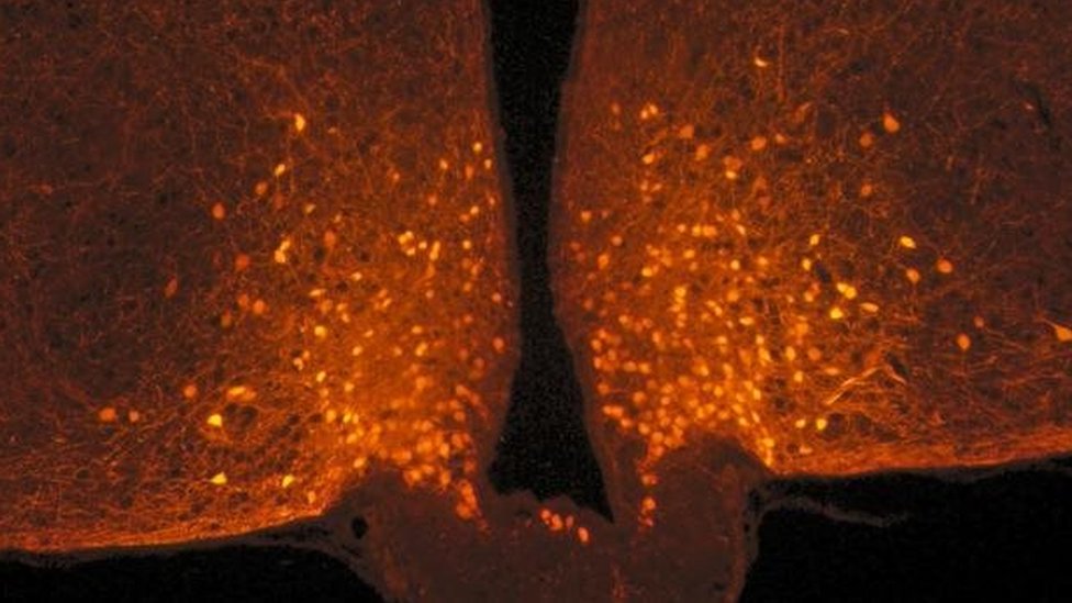 Imagen cerebral.