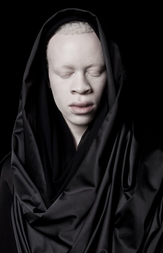 In Pictures Albinism And Perceptions Of Beauty c News