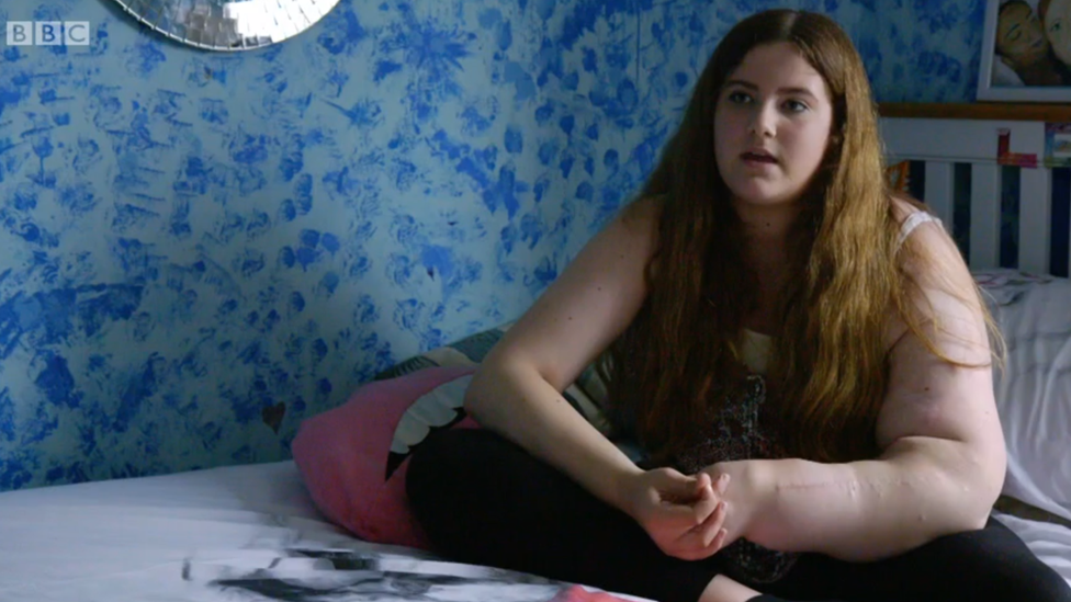 En sus 14 años de vida Leah ha tenido que someterse a más de 30 operaciones para reducir el tamaño de su brazo. Leah Hardcastle a los 14 años