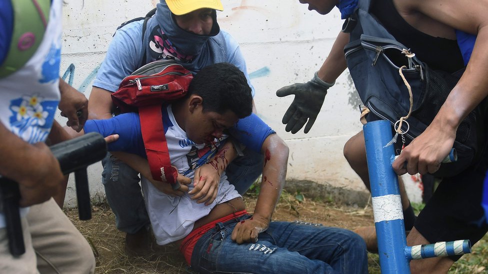 Joven herido en Nicaragua