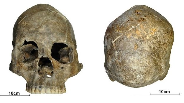 Dundee Scientists Probe 9 000 Year Old Decapitation c News