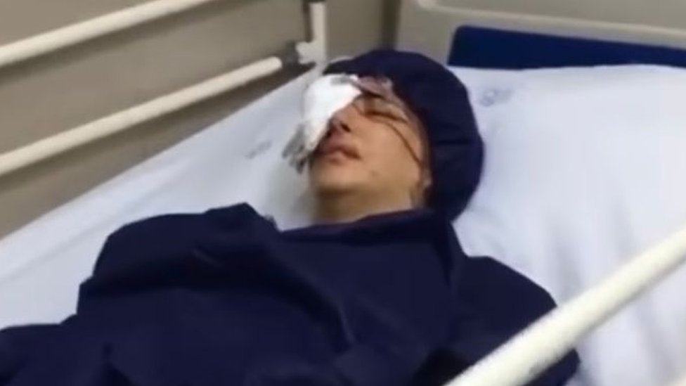 Elahe Tavokolian in hospital after being shot in the eye