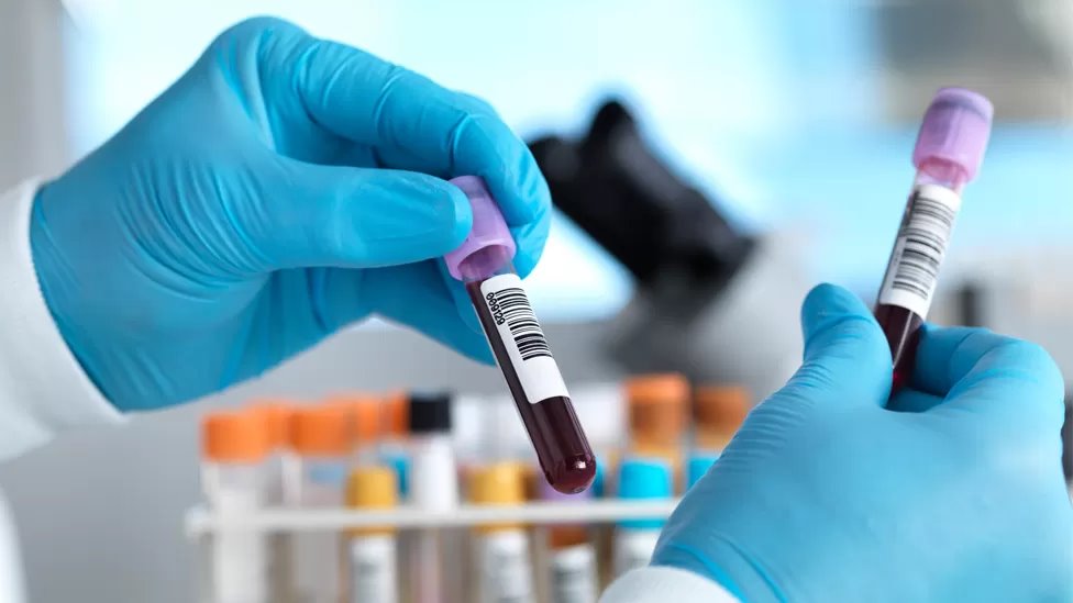 Ученые: новый метод выявления рака по анализу крови дает хорошие результаты. 2 из 3 диагнозов верны