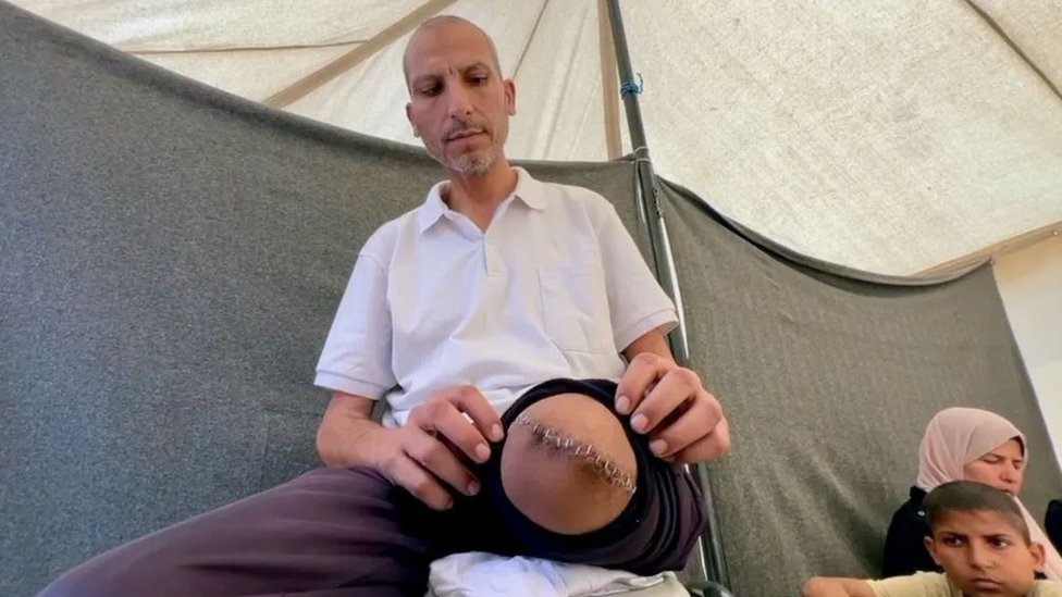 Sufijanova noga je bila amputirana i on je kasnije pušten nazad u Gazu