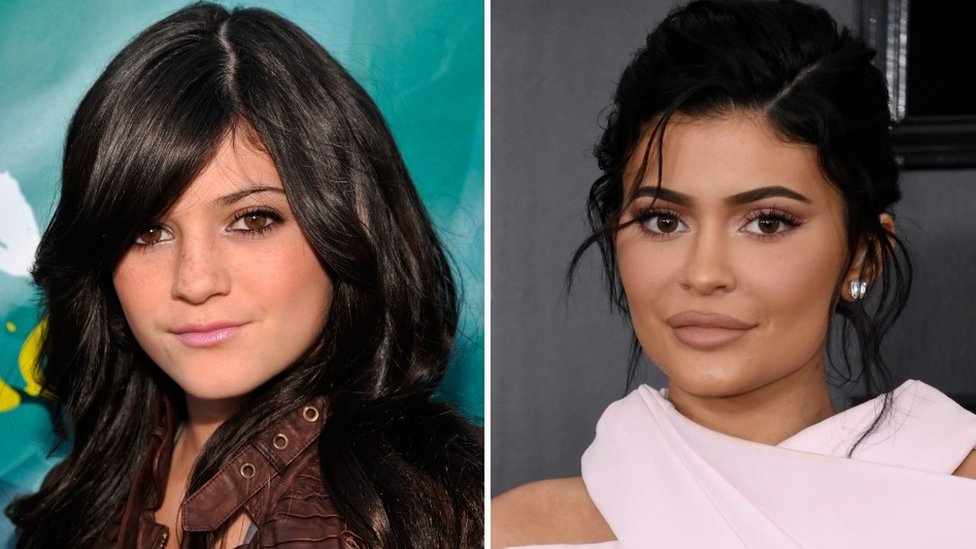 Kylie Jenner - Age, Cosmetics & Daughter