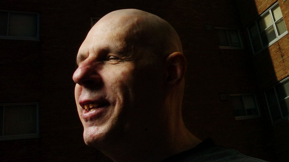 Dejó de ser Joe de 33 años de edad para convertirse en Joybubbles, de 5 años de edad. Joybubbles