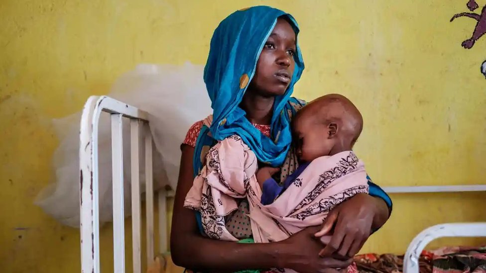 امرأة أفريقية تحمل رضيعا يعاني سوء التغذية