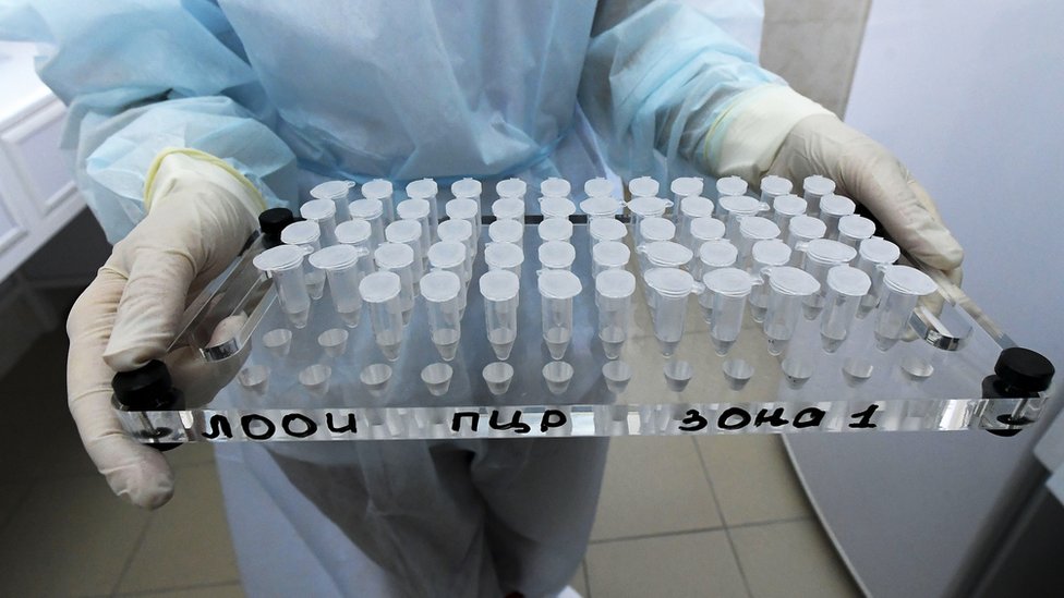 Rusya'daki koronavirüs test kitleri