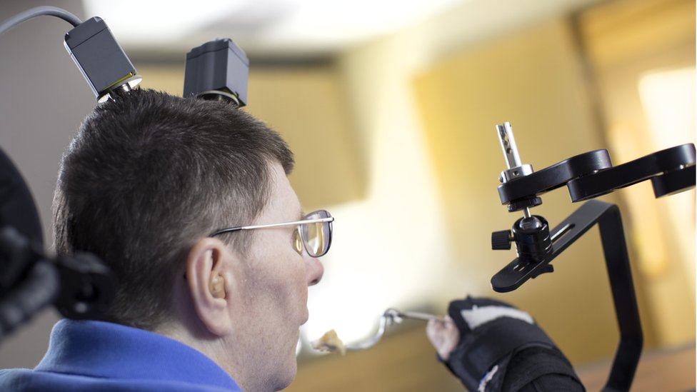 Bill Kochevar, de 53 años, que se quedó tetrapléjico hace ocho años tras un accidente de bicicleta. Bill Kochevar, de 53 años, que se quedó tetrapléjico hace ocho años tras un accidente de bicicleta.