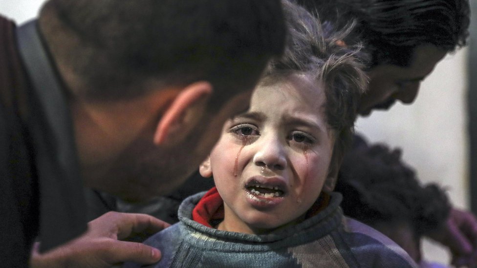 Niña herida en Siria