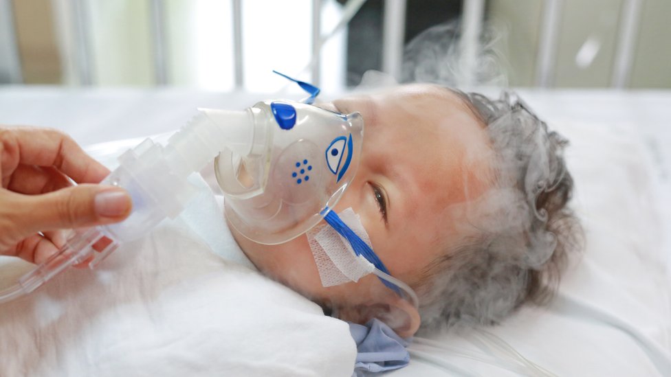 Niño con enfermedad respiratoria