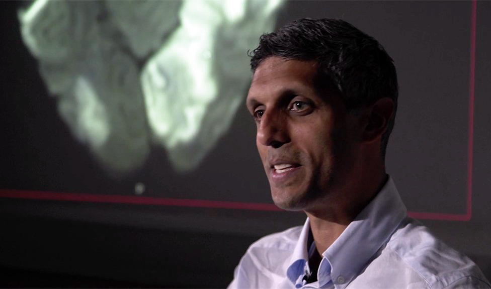 Консультант невролог Арвинд Чандратева с сканированием мозга