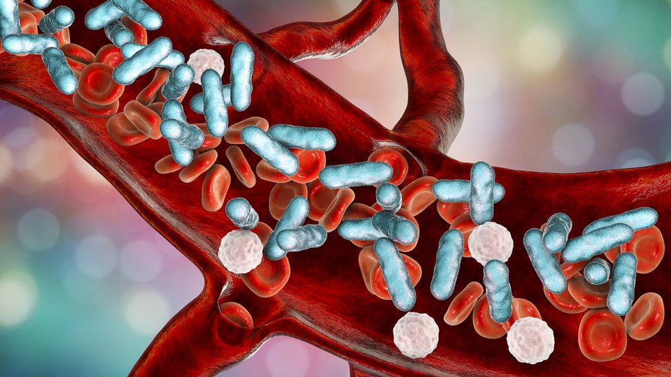 Иллюстрация, показывающая бактерии, движущиеся через кровь.