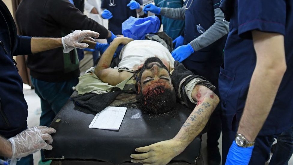 Un herido yace en un hospital tras el mortífero terremoto que sacudió Siria al amanecer del 6 de febrero de 2023 en el distrito de Salaheddine, en Alepo.