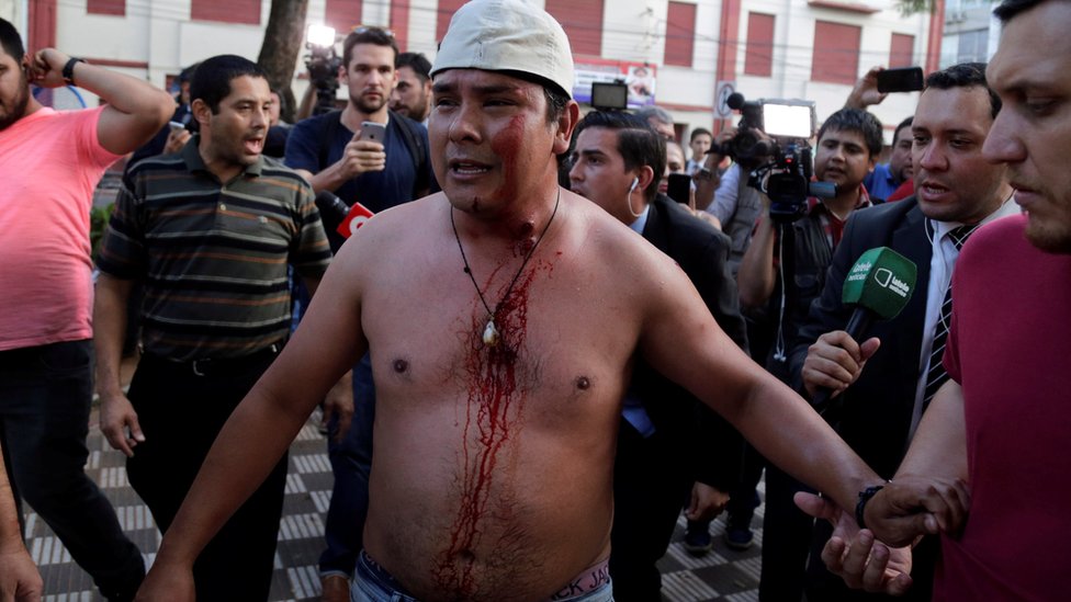 La policía rodeó el Congreso mientras los senadores votaban la polémica ley a puertas cerradas. Manifestante lesionado