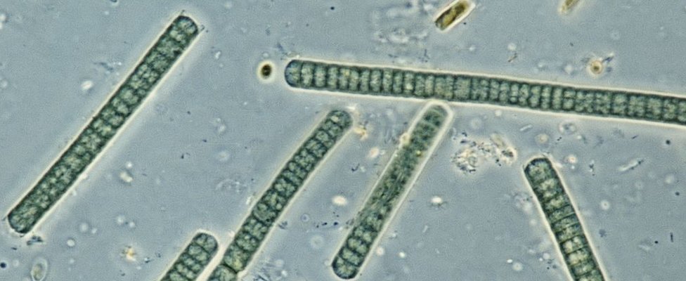 Oscillatoria, род cyanobacterium, сине-зеленые водоросли под микроскопом.