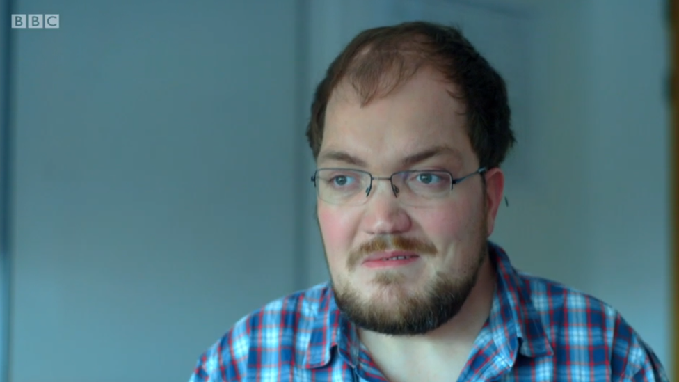 Inicialmente todo empezó con un episodio de parálisis facial. Tim