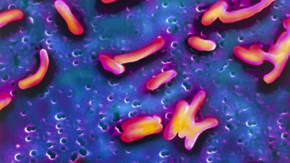 صورة مجهرية للبكتيريا المسببة للكوليرا
