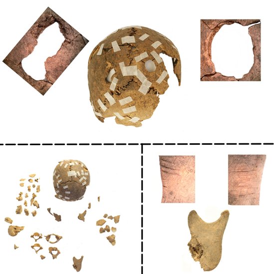 Detalles de los orificios y laceraciones encontrados en los cráneos y huesos de la mándibula