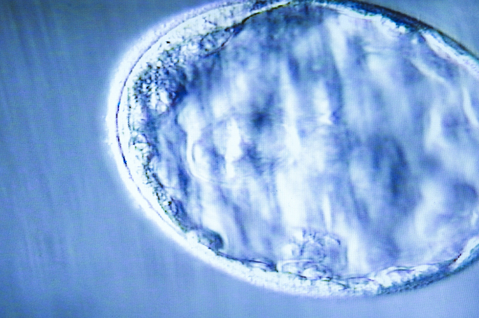 Imagen de un embrión de 5 o 6 días