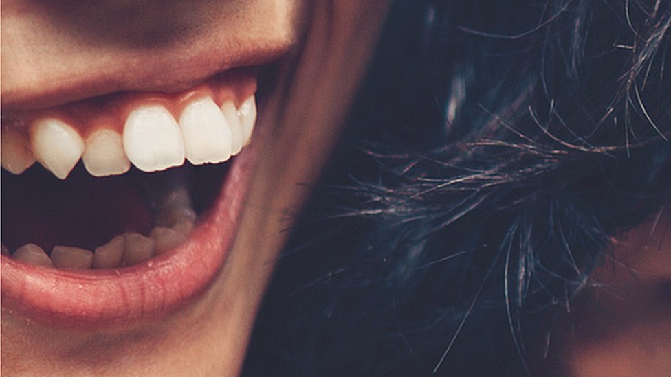 El colmillo puntudo es típico de yaeba, así como los dientes desalineados. Sonrisa de japonesa