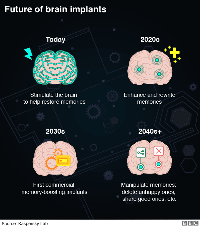 Infographic showing the prospects for development of brain implants (PLEASE CHECK THE DIGIHUB EMAIL FOR INSTRUCTIONS ON HOW TO REVERSION IT)