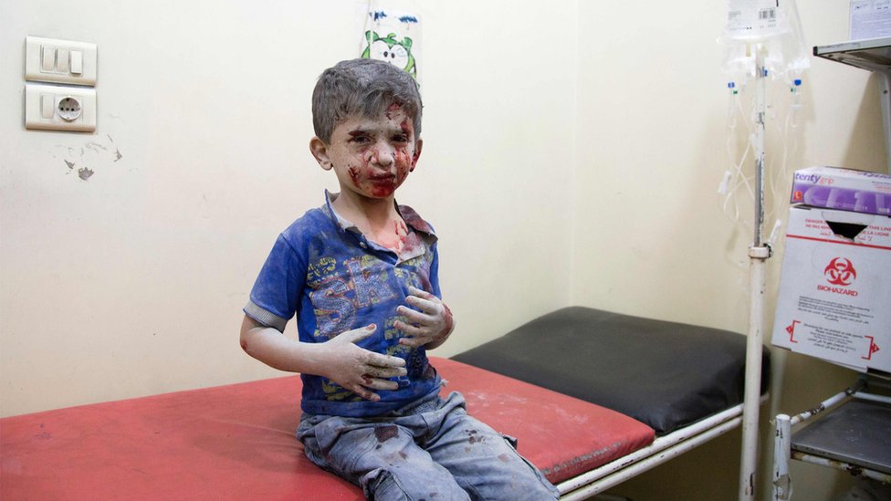 Сирийский мальчик ожидает лечения в временном госпитале после авиаудара по удерживаемым повстанцами восточным районам Алеппо 24 сентября 201 г.