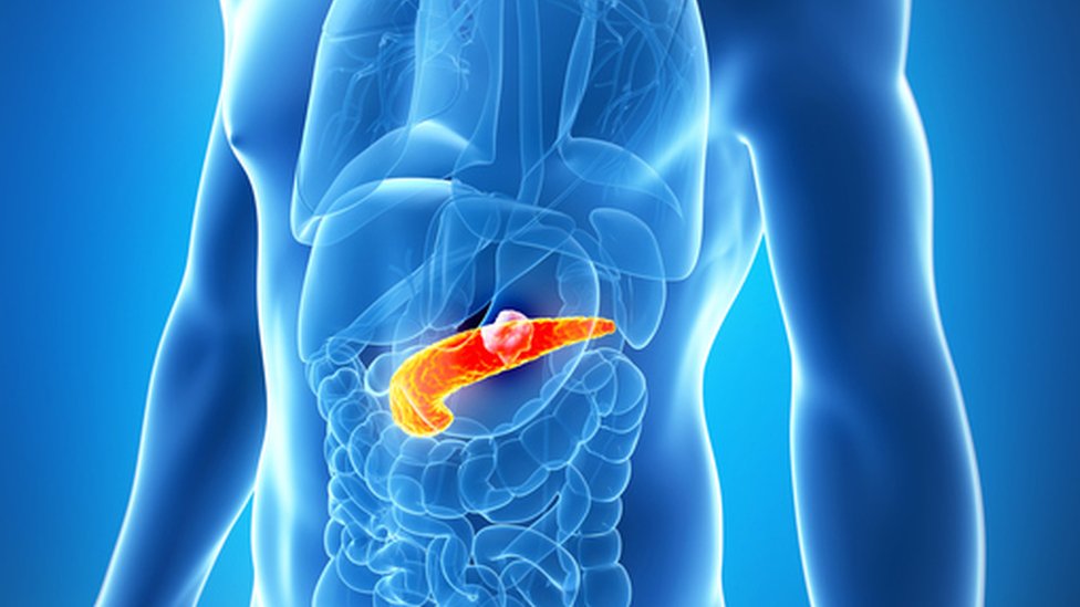 Illustration of the human body with the pancreas highlighted.