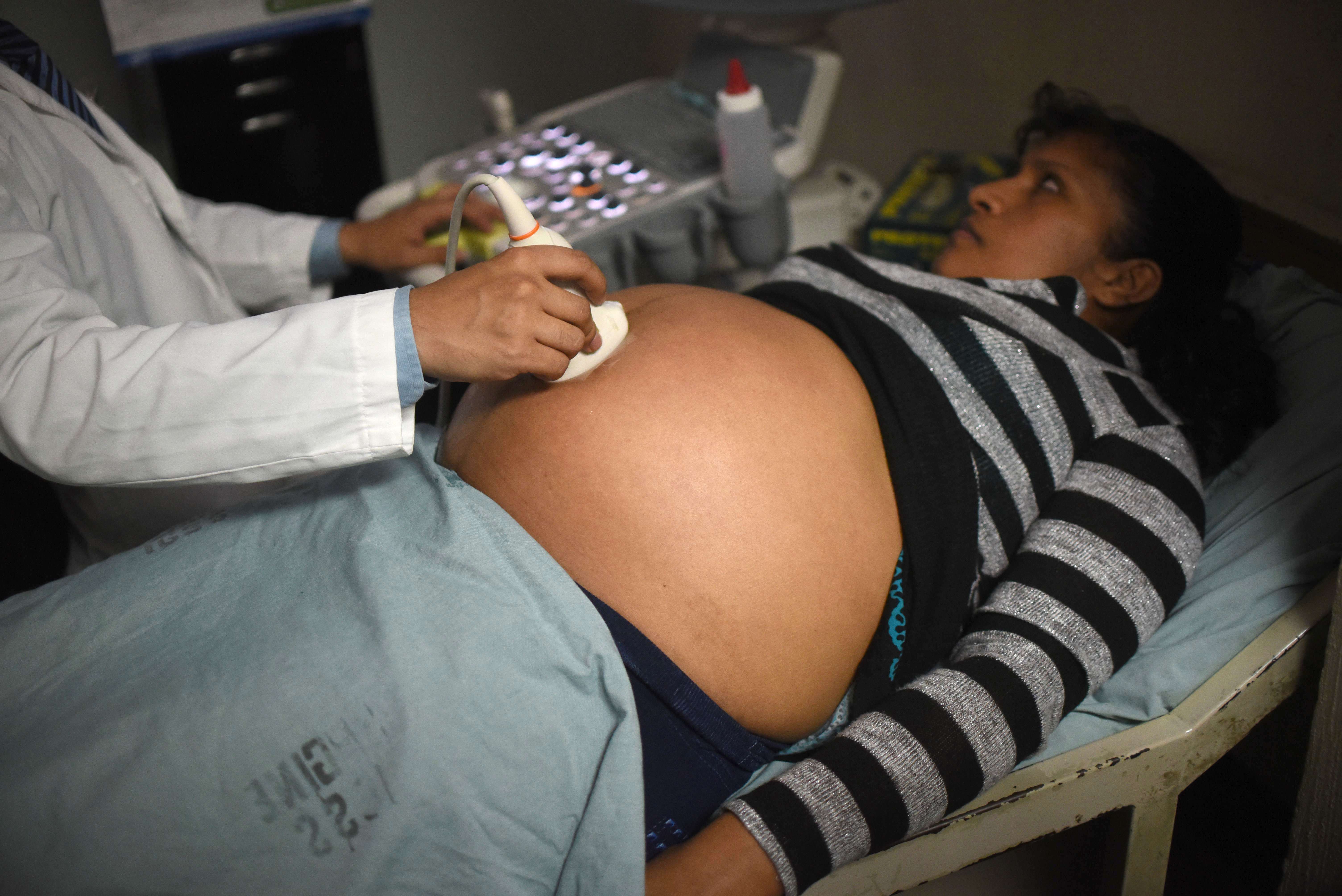 Беременная женщина проходит УЗИ в родильном отделении города Гватемала.