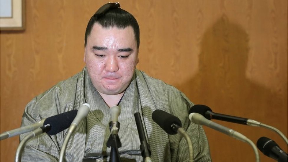 El campeón de sumo japonés Harumafuji anunció el miércoles su retiro tras una brutal golpiza a un rival en un bar. El campeón de sumo japonés Harumafuji.