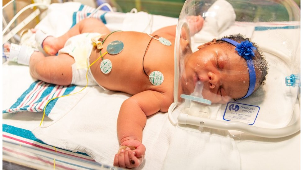 Us Baby Born On 9 11 At 9 11 Weighs 9lb 11oz c News