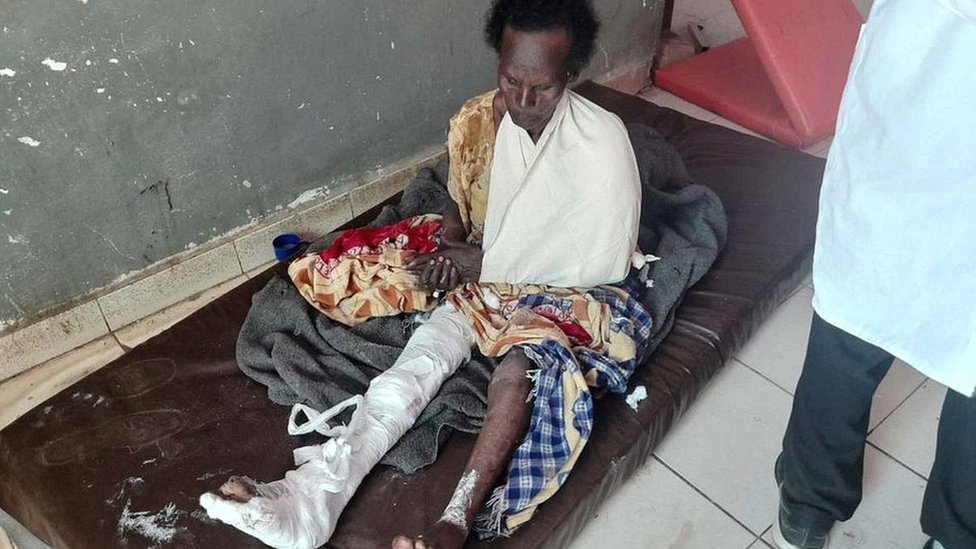 سيدة مصابة في هجوم صاروخي في إثيوبيا