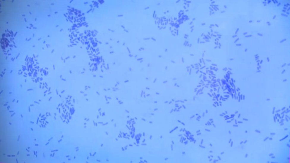 Микроскопическое изображение мазков бактерий