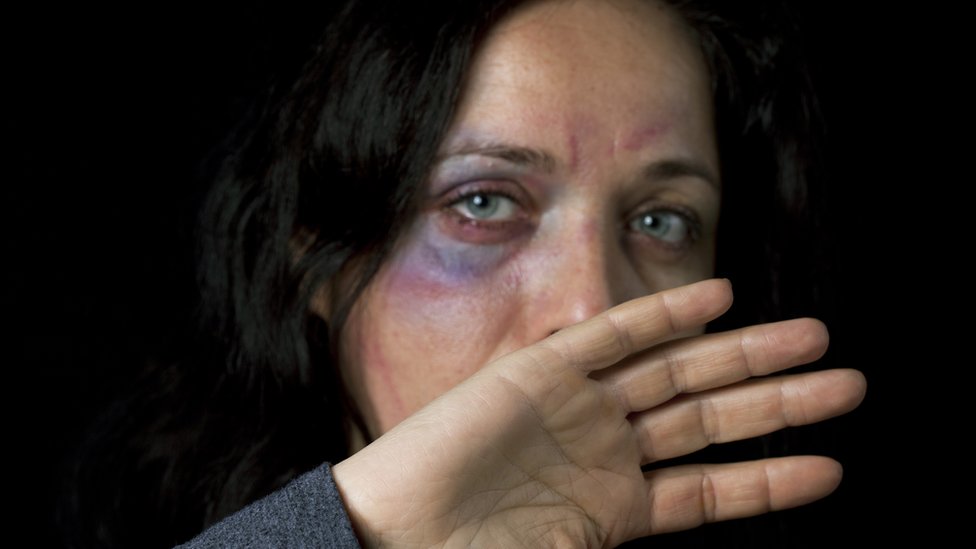 Сток-фото травмированной женщины, защищающей себя (изображение модели)
