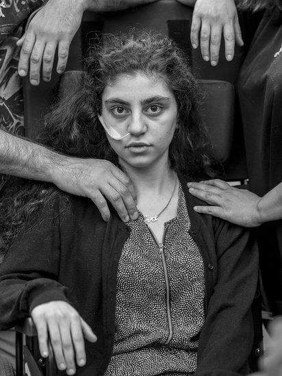 Adolescente despertando del estado catatónico. Adolescente despertando del estado catatónico.