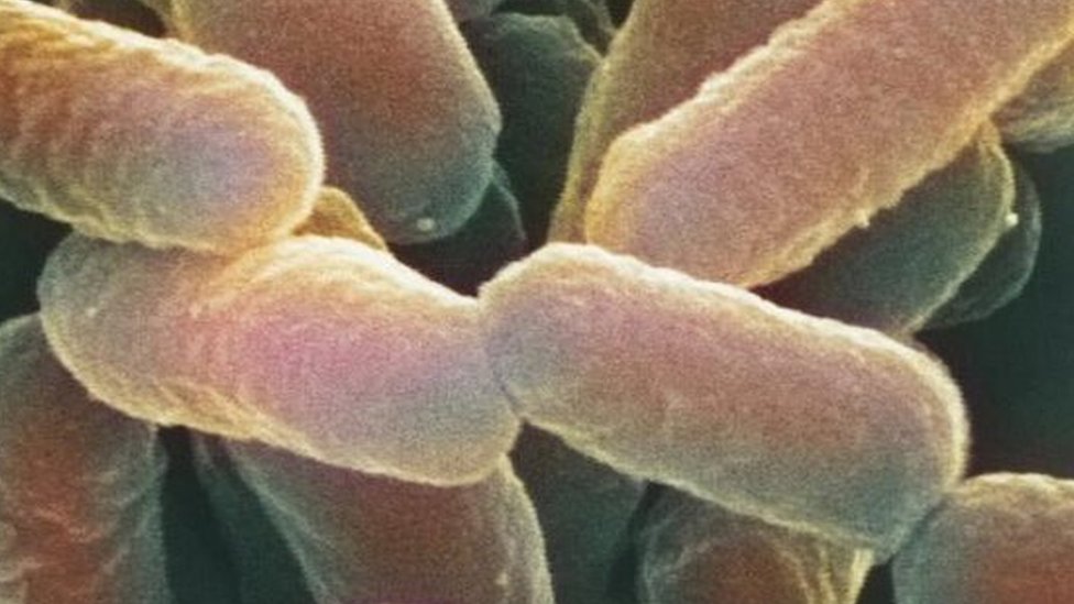 Цветной снимок, полученный с помощью сканирующего электронного микроскопа (СЭМ) Escherichia coli 0157: H7