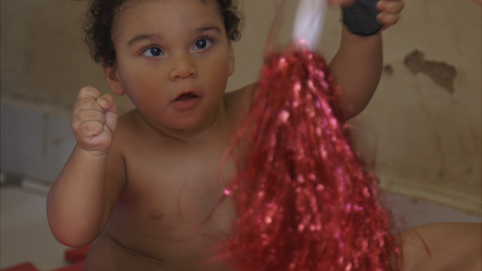 El primer año de vida es un período fundamental para el desarrollo del cerebro y la visión de los niños afectados por el zika, según expertos. João Miguel