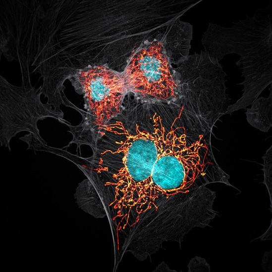 Células que se dividen Células que se dividen