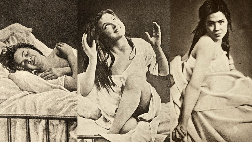Tres imágenes de "Iconographie Photographique de la Salpetriere"