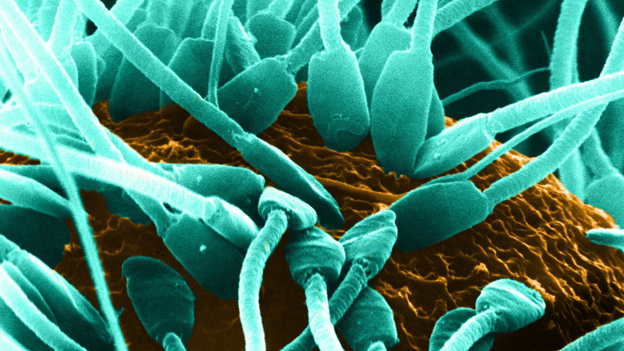 SPLMutant sperm-factories spread in testes