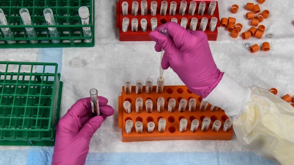 Análise de vacina em laboratório
