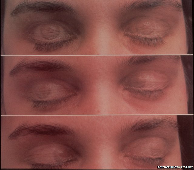 серия изображений, показывающих движение глаз