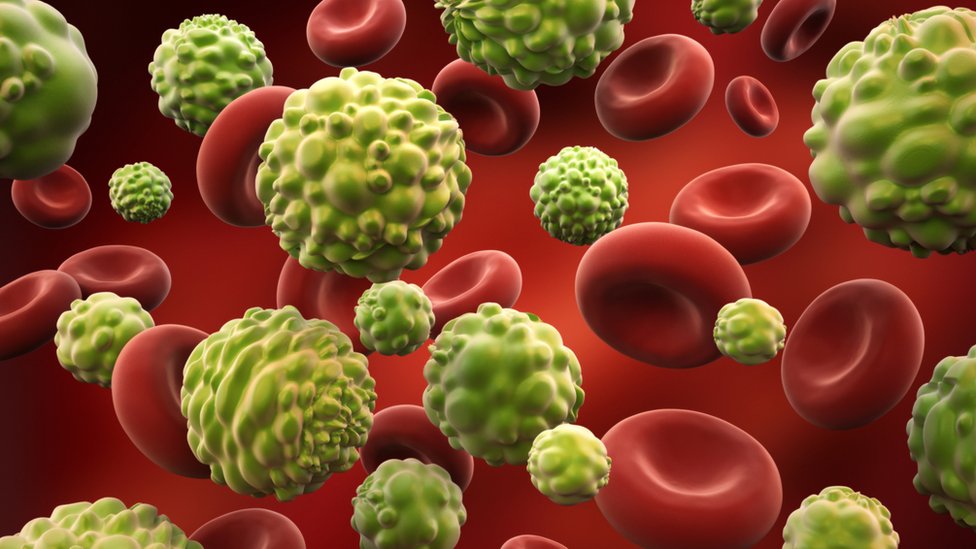 Representación de células cancerígenas en el sistema sanguíneo.