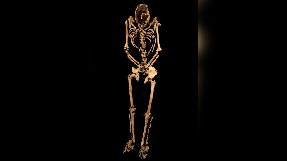 Crucified Man Skeleton