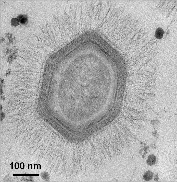 Imagem microscópica do mimivírus