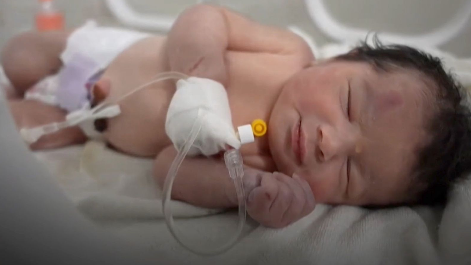 Newborn Afraa in the hospital getting treatment